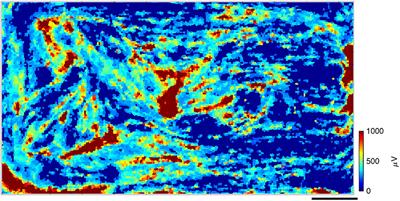 Long-Term High-Density Extracellular Recordings Enable Studies of Muscle Cell Physiology